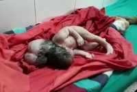 Bayi Berkepala Tiga Bayi Berkepala Tiga